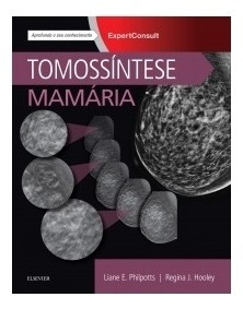 Tomossíntese Mamária- 1a Edição