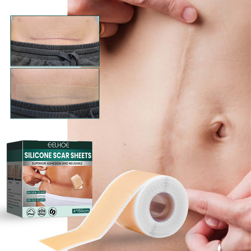 Pegatinas Para Encubrir Tatuajes, Pegatinas Para Cubrir La P