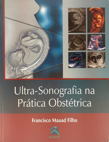 Livro - Ultra Sonografia Na Pratica Obstetrica - Revinter