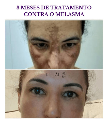 Fórmula Antioxi Nutri | Trans Resveratrol | Pinus Pinaster Sem Sabor