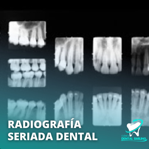 Rx Seriada Dental