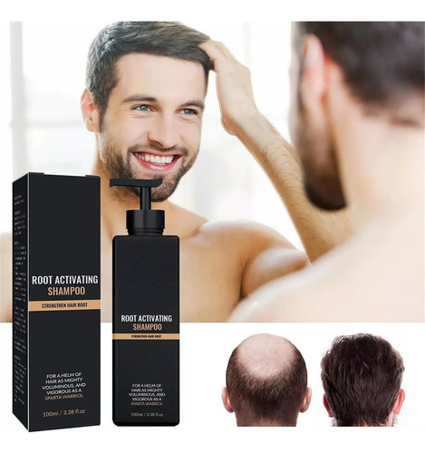 ChampĂș Root Activator Para El Crecimiento Del Cabello Para H