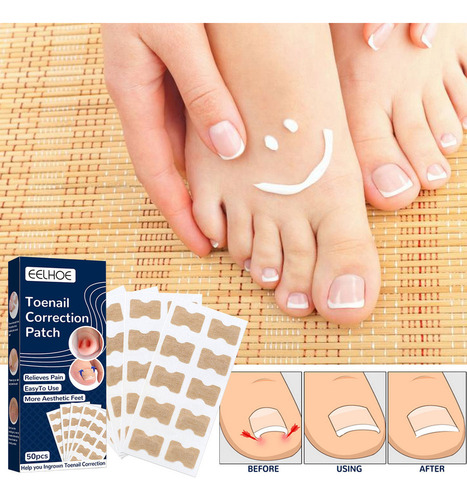 Mox Parche Corrector De Uñas De Los Pies, Parche Reparador