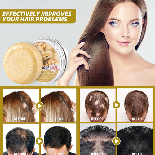 Barras De ChampĂș Para El Crecimiento Del Cabello De Jengibre