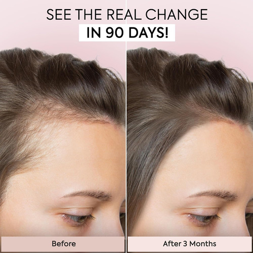 Sérum Para El Crecimiento Del Cabello Jardient Veganic Natur