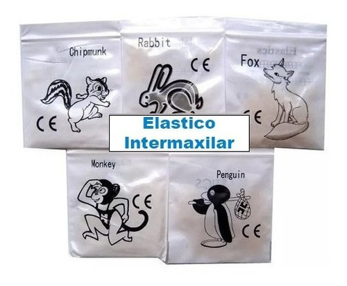 Elásticos Intermaxilares Ortodoncia - Elásticos Intraorales