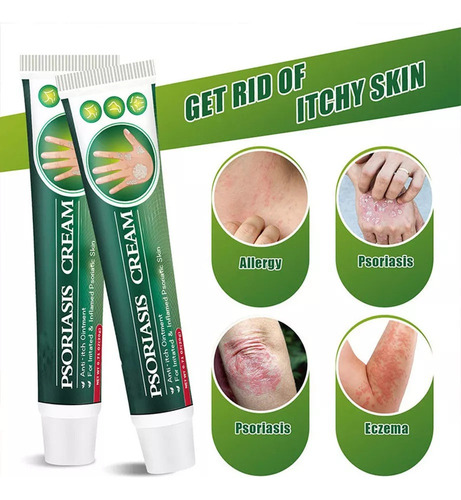 Xinnuo Mz D Crema Dermatofito Psoriasis Crema Dermatofito