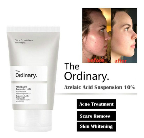 The Ordinary Azelaic Acid Suspension 10% (30ml) Melasma Acne