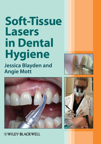 Libro:  Soft-tissue Lasers In Dental Hygiene