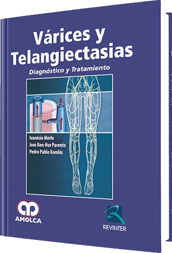 Várices Y Telangiectasias Diagnóstico Y Tratamiento / Amolca