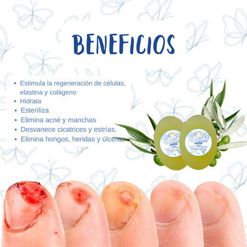 Jabón Con Aceite Ozonizado Organico Aclara Paño Manchas 2pz