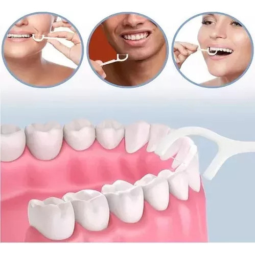 Perlas Reparación Dientes Postizos Dientes Gránulos 60ml