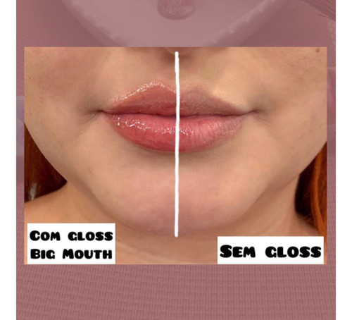 Volume Gloss Glitter Aumenta Efeito Boca Grande Big Mouth