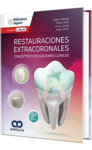 Restauraciones Extracoronales. Conceptos Y Aplicac. Clínicas