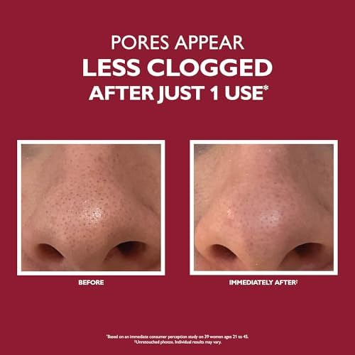 Peter Thomas Roth | Microdermoabrasión Incluso Más Suave