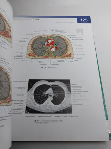 Sobotta Atlas De Anatomía Humana Vol.1 Y 2, Edicion 22