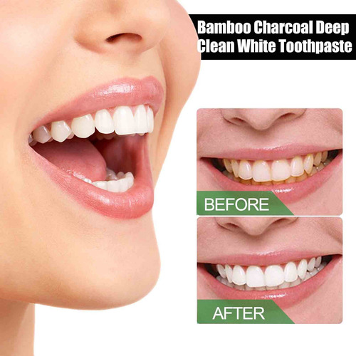 Pasta De Dientes Con Carbón, Pasta De Dientes Clean White, C