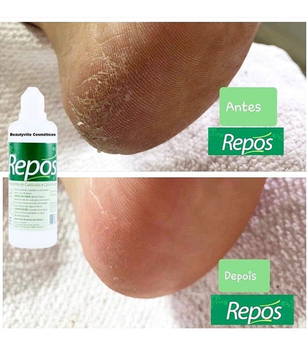Espatula Bisturi 222 P/ Calosidade + Amaciante 1,1 Lt Repos