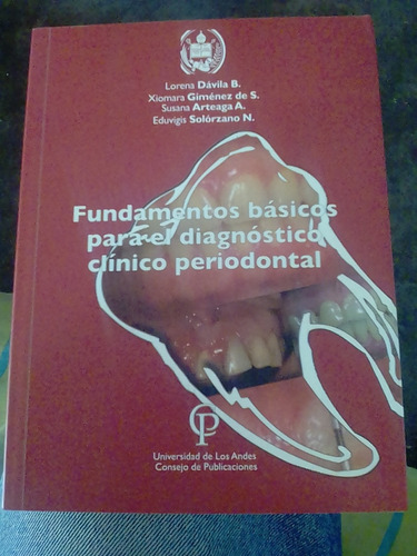 Fundamentos Básicos Para El Diagnóstico Clínico Periodontal 