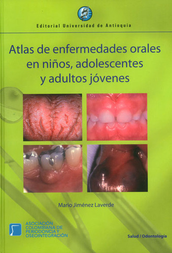 Atlas De Enfermedades Orales En Niños, Adolescentes Y Adultos Jóvenes, De Mario Jiménez Laverde. Editorial U. De Antioquia, Tapa Dura, Edición 2011 En Español