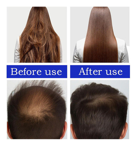 Xinnuo Aceite Para El Crecimiento Del Cabello, 60 Ml* 2 R