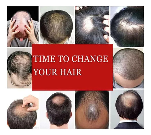 - Pelucas Negras De Pelo Corto Para Hombre