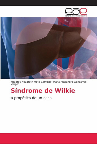 Libro Síndrome De Wilkie: A Propósito De Un Caso (spani Lcm7