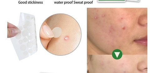 Elimina Acne Parche Hidrocoloide Aplicacion Individual Efect