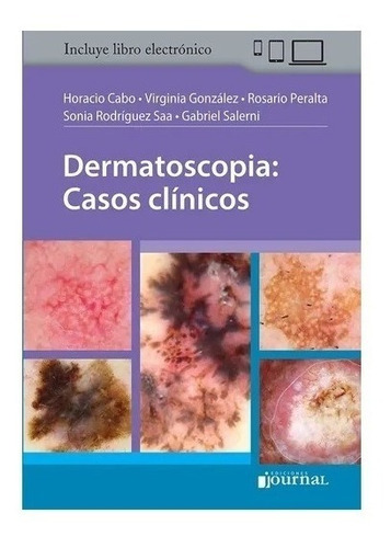 Cabo Dermatoscopia: Casos Clínicos Novedad Nuevo !