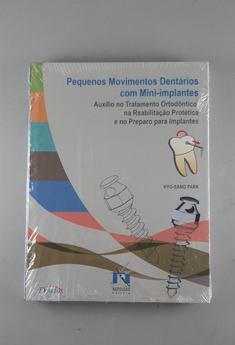 Movimentos Dentários Mini-implantes Livro Odontologico