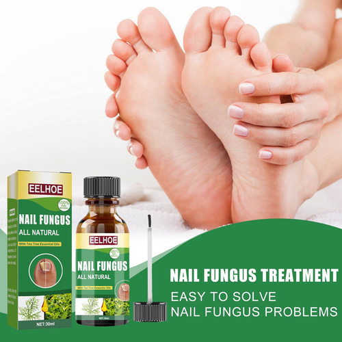 - Solución Contaminante Para El Cuidado De Las Uñas, 30 Ml