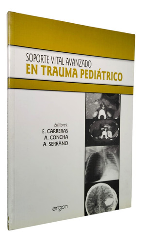 Soporte Vital Avanzado En Trauma Pediatrico - Carreras