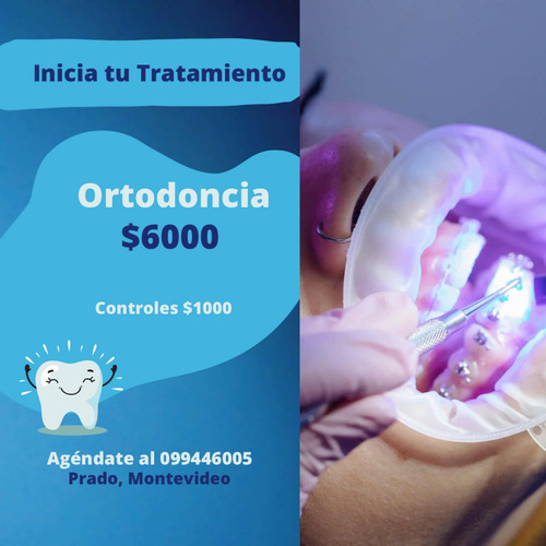Imagen 4 de 5 de Limpieza Dental Completa, Consultorio Dental
