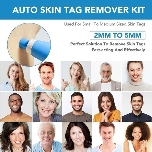 Kit De Eliminación De Piel Lescolton Auto Tag Remover Reloj