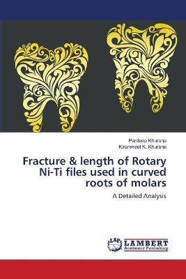 Libro Fracture & Length Of Rotary Ni-ti Files Used In Cur...