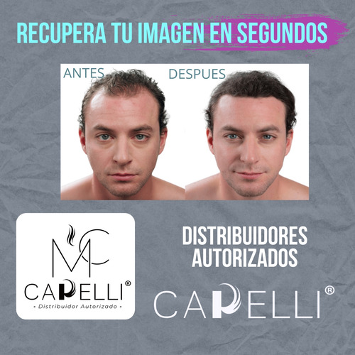 2pz Capelli® 21gr Microfibra Capilar Calvicie Caida Cabello Castaño Oscuro