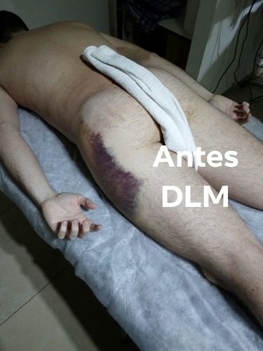 Drenaje Linfático Manual-masajes-depilación Masculina