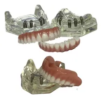 Comprar Modelos Odontológicos Protocolos E Overdenture B Clip - K3