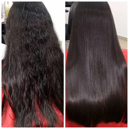 Cirugia Capilar Celulas Madres Litro K - L a $44000