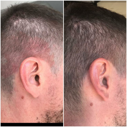 Shampoo Anticaspa Coceira Escamação Novavida 240ml