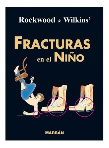 Rockwood Fracturas En El Niño - Residente