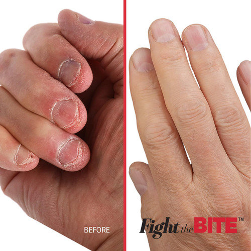 Cuccio Fight The Bite - Esmalte De Uñas Transparente Sin Mor