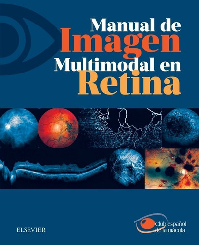 Manual De Imagen Multimodal En Retina, De Club Español De La Mácula. Editorial Elsevier, Tapa Blanda En Español, 2017