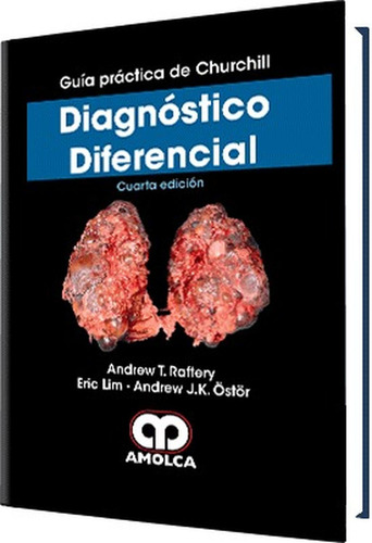 Guía Práctica De Churchill Diagnóstico Diferencial