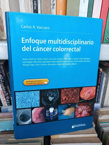 Enfoque Multidisciplinario Del Cáncer Colorrectal, Vaccaro