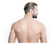 Comprar Depilación Definitiva Ipl Espalda Y Hombros