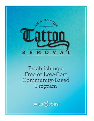 Libro Tattoo Removal: Establishing A Free Or Low-cost Com...