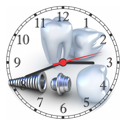 Relógio De Parede Dentista Odontologia Dentes Implante 40 Cm