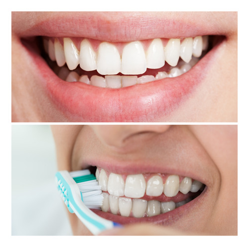 60 Escova De Dente C/ Protetor De Cerdas Atacado