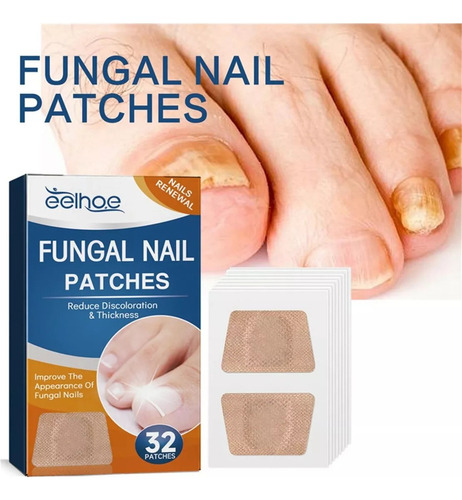 Parches De Reparación De Uñas F Nail Patches 1box